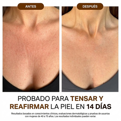 Aceite Corporal Efecto Tensor