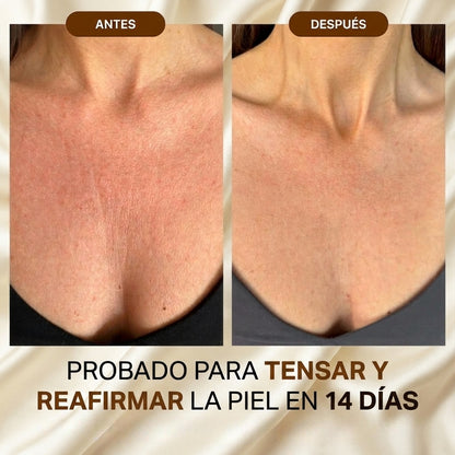 Aceite Corporal Efecto Tensor